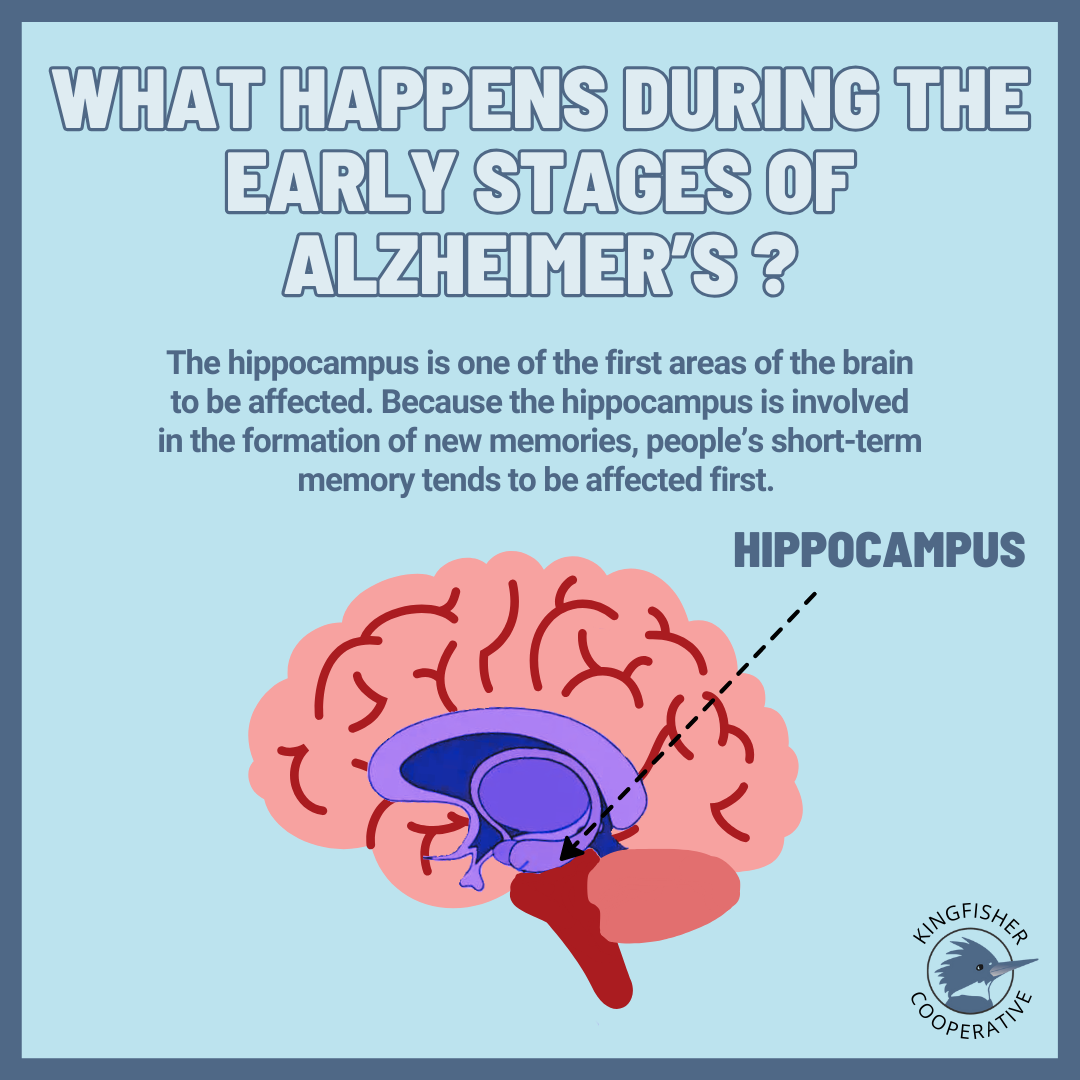 Cartoon brain with arrow pointing at the hippocampus. Text says, "What happens during the early stages of Alzheimer's? The hippocampus is one of the first areas of the brain to be affected. Because the hippocampus is involved in the formation of new memories, people's short term memory tends to be affected first.